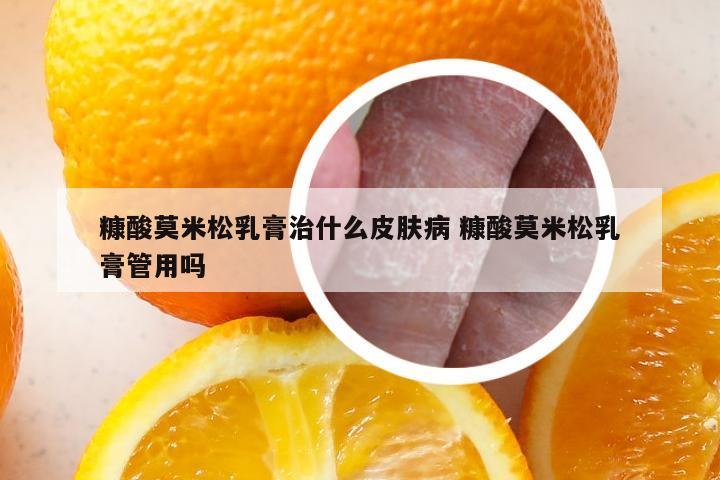 糠酸莫米松乳膏治什么皮肤病 糠酸莫米松乳膏管用吗