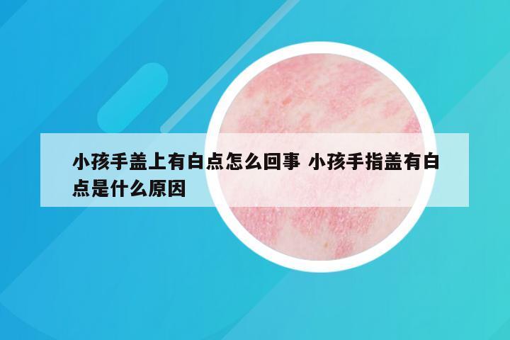 小孩手盖上有白点怎么回事 小孩手指盖有白点是什么原因