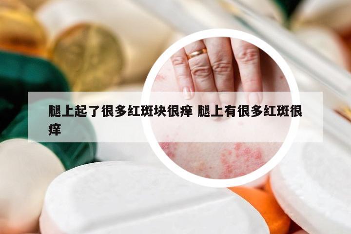 腿上起了很多红斑块很痒 腿上有很多红斑很痒