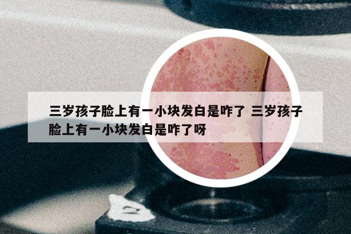 三岁孩子脸上有一小块发白是咋了 三岁孩子脸上有一小块发白是咋了呀