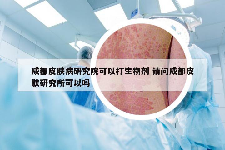 成都皮肤病研究院可以打生物剂 请问成都皮肤研究所可以吗