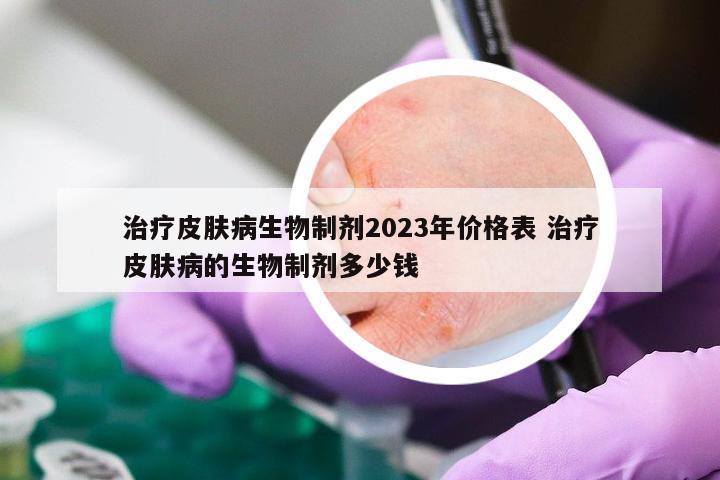 治疗皮肤病生物制剂2023年价格表 治疗皮肤病的生物制剂多少钱