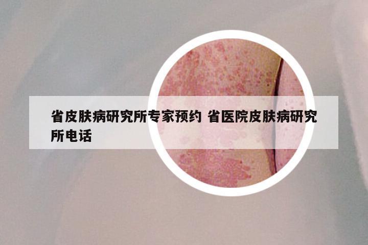 省皮肤病研究所专家预约 省医院皮肤病研究所电话