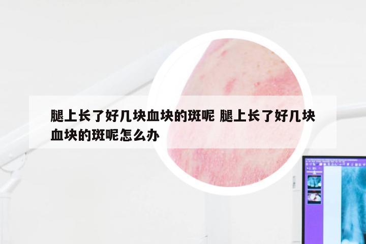 腿上长了好几块血块的斑呢 腿上长了好几块血块的斑呢怎么办