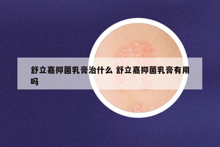 舒立嘉抑菌乳膏治什么 舒立嘉抑菌乳膏有用吗