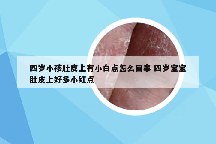 四岁小孩肚皮上有小白点怎么回事 四岁宝宝肚皮上好多小红点