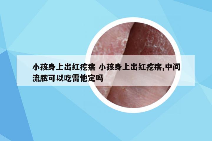 小孩身上出红疙瘩 小孩身上出红疙瘩,中间流脓可以吃雷他定吗