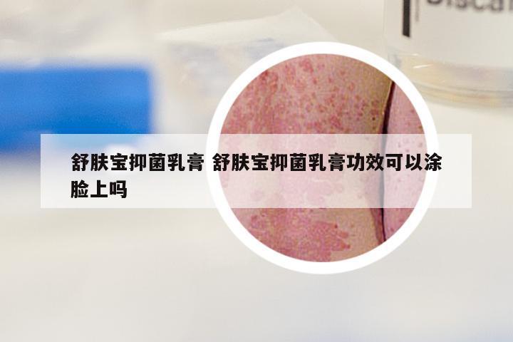 舒肤宝抑菌乳膏 舒肤宝抑菌乳膏功效可以涂脸上吗