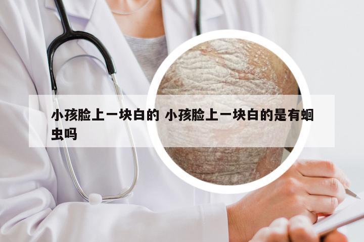 小孩脸上一块白的 小孩脸上一块白的是有蛔虫吗