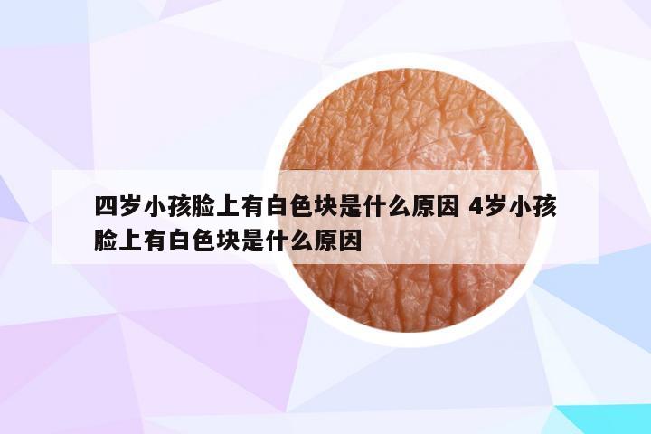 四岁小孩脸上有白色块是什么原因 4岁小孩脸上有白色块是什么原因