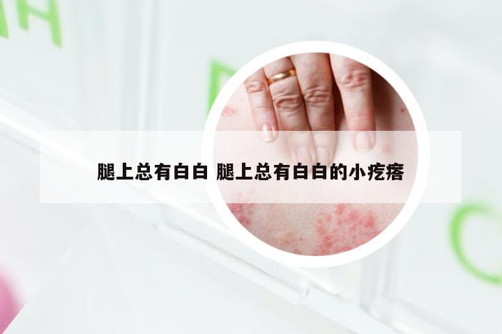 腿上总有白白 腿上总有白白的小疙瘩