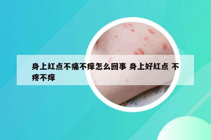 身上红点不痛不痒怎么回事 身上好红点 不疼不痒