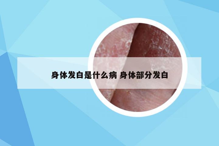 身体发白是什么病 身体部分发白