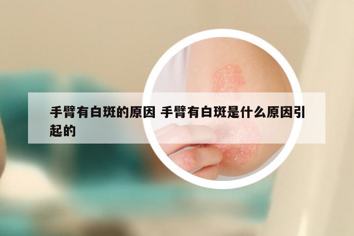 手臂有白斑的原因 手臂有白斑是什么原因引起的