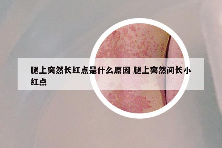 腿上突然长红点是什么原因 腿上突然间长小红点