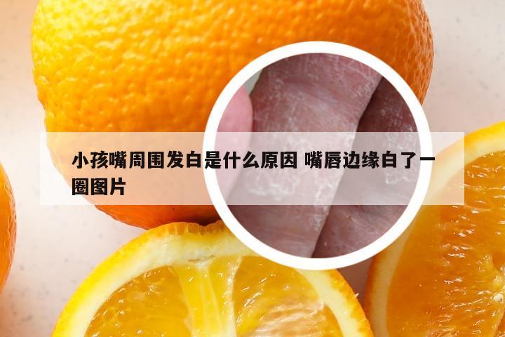 小孩嘴周围发白是什么原因 嘴唇边缘白了一圈图片