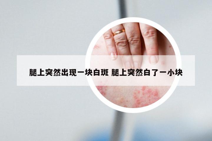 腿上突然出现一块白斑 腿上突然白了一小块