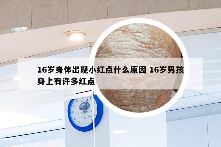 16岁身体出现小红点什么原因 16岁男孩身上有许多红点