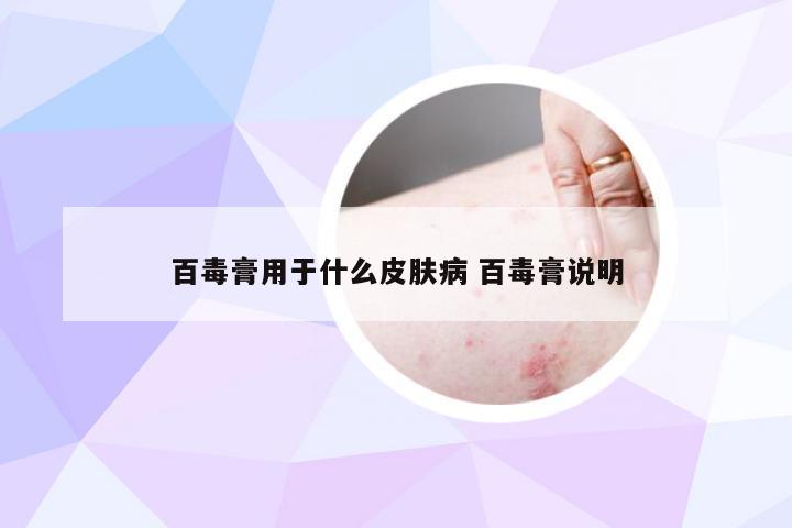 百毒膏用于什么皮肤病 百毒膏说明