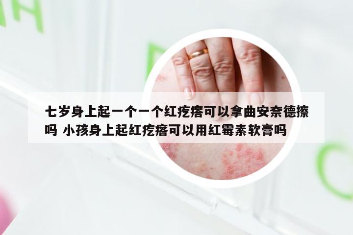 七岁身上起一个一个红疙瘩可以拿曲安奈德擦吗 小孩身上起红疙瘩可以用红霉素软膏吗