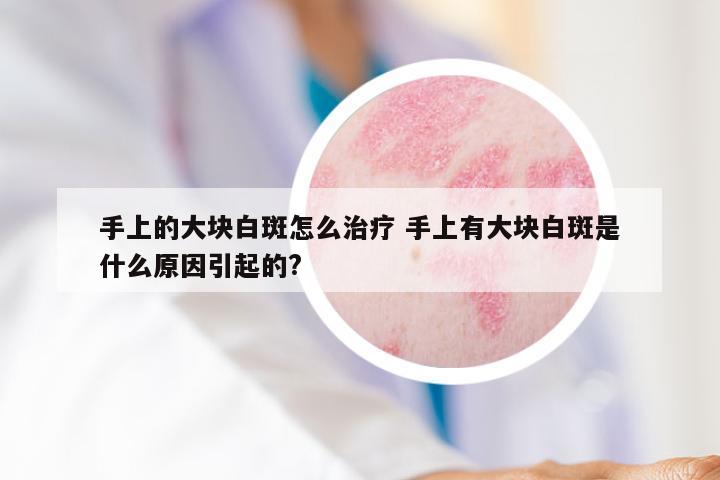 手上的大块白斑怎么治疗 手上有大块白斑是什么原因引起的?