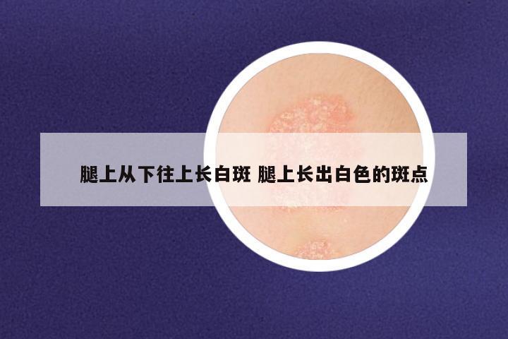 腿上从下往上长白斑 腿上长出白色的斑点