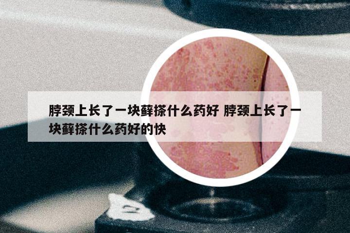 脖颈上长了一块藓搽什么药好 脖颈上长了一块藓搽什么药好的快