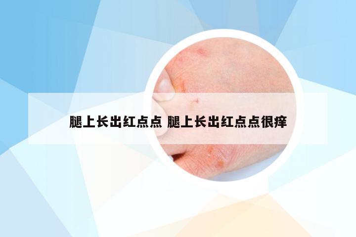 腿上长出红点点 腿上长出红点点很痒