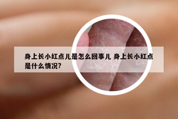 身上长小红点儿是怎么回事儿 身上长小红点是什么情况?