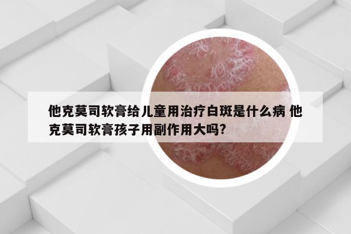 他克莫司软膏给儿童用治疗白斑是什么病 他克莫司软膏孩子用副作用大吗?