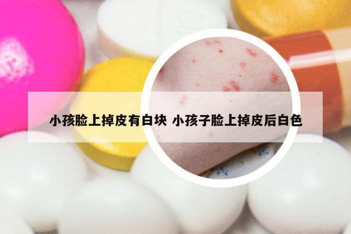 小孩脸上掉皮有白块 小孩子脸上掉皮后白色