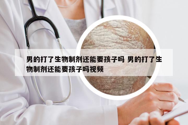 男的打了生物制剂还能要孩子吗 男的打了生物制剂还能要孩子吗视频