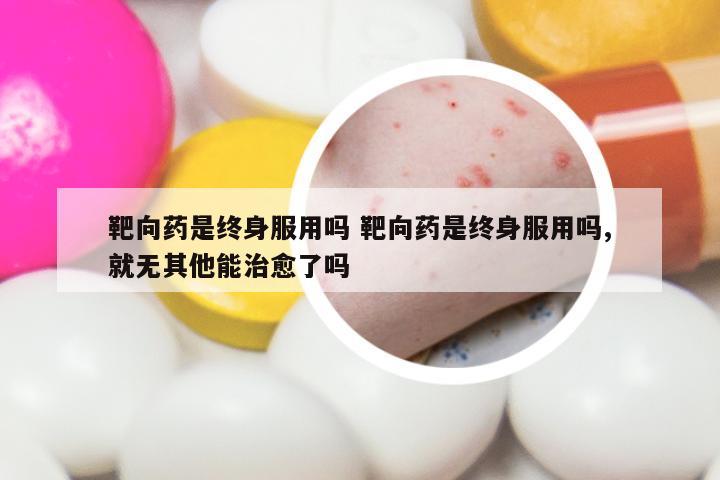 靶向药是终身服用吗 靶向药是终身服用吗,就无其他能治愈了吗