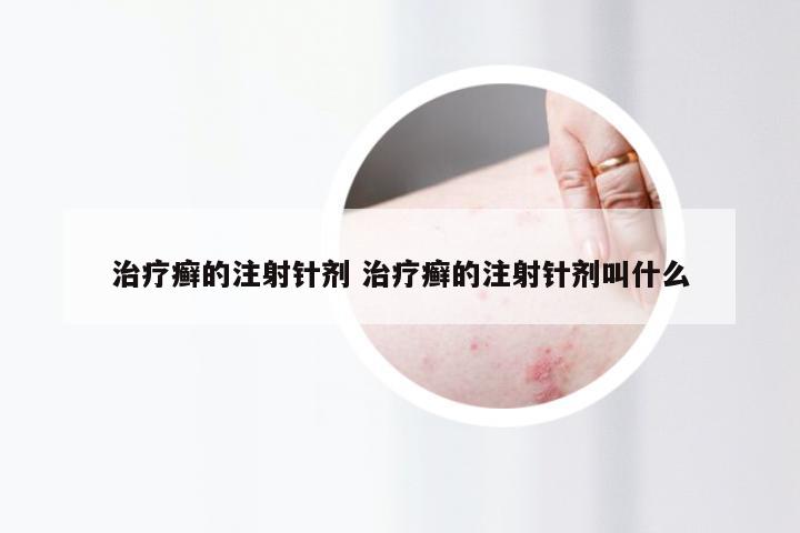 治疗癣的注射针剂 治疗癣的注射针剂叫什么