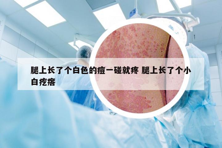 腿上长了个白色的痘一碰就疼 腿上长了个小白疙瘩