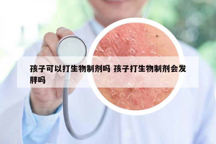 孩子可以打生物制剂吗 孩子打生物制剂会发胖吗