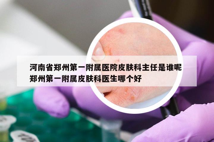 河南省郑州第一附属医院皮肤科主任是谁呢 郑州第一附属皮肤科医生哪个好