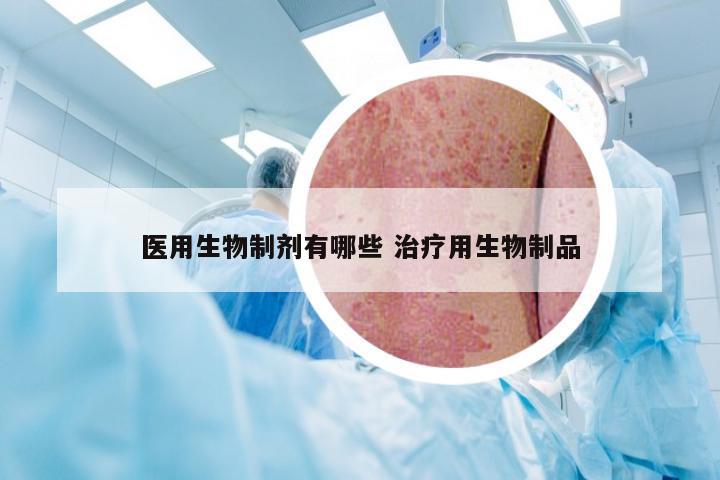 医用生物制剂有哪些 治疗用生物制品