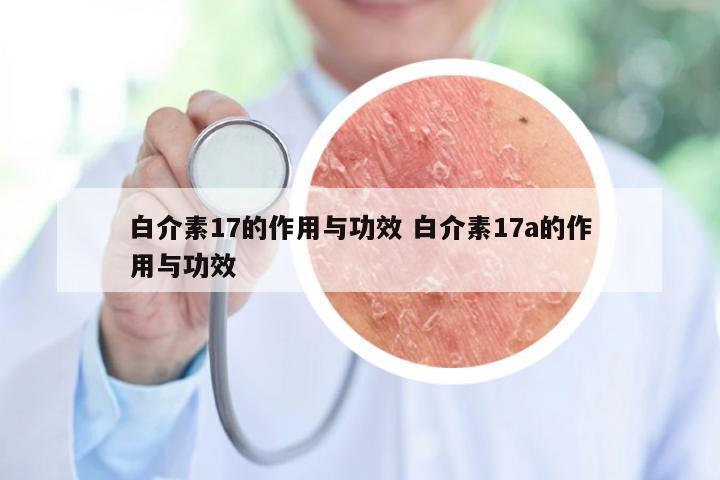 白介素17的作用与功效 白介素17a的作用与功效