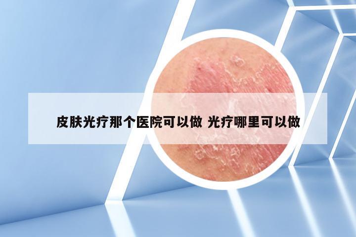 皮肤光疗那个医院可以做 光疗哪里可以做