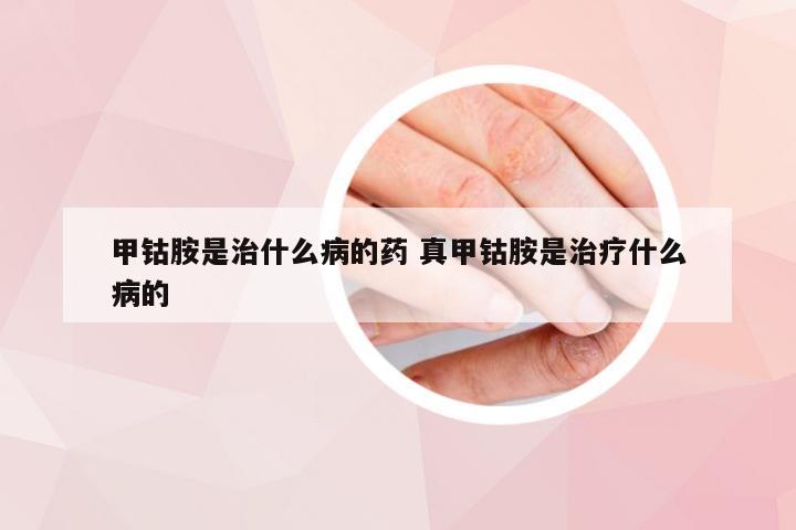 甲钴胺是治什么病的药 真甲钴胺是治疗什么病的