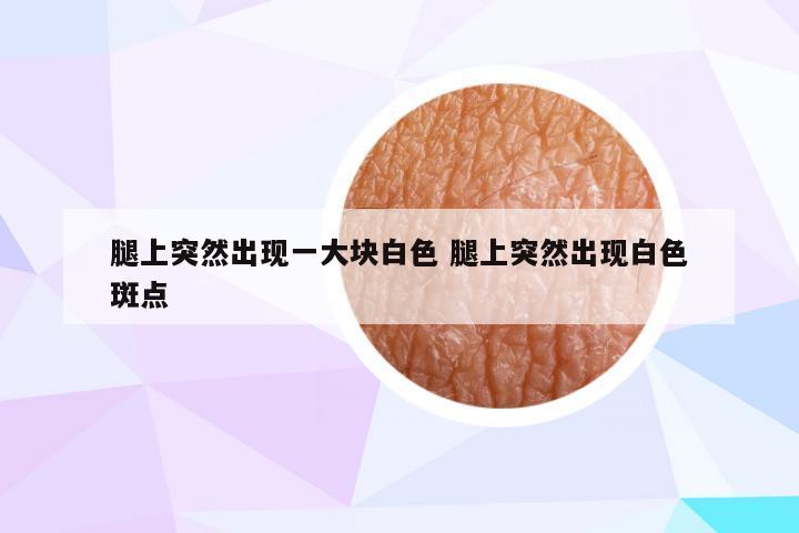 腿上突然出现一大块白色 腿上突然出现白色斑点