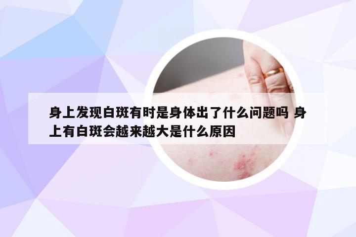 身上发现白斑有时是身体出了什么问题吗 身上有白斑会越来越大是什么原因