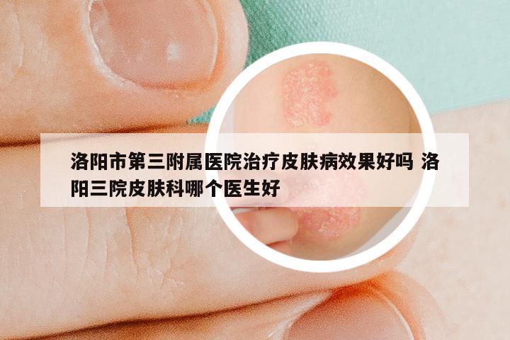 洛阳市第三附属医院治疗皮肤病效果好吗 洛阳三院皮肤科哪个医生好