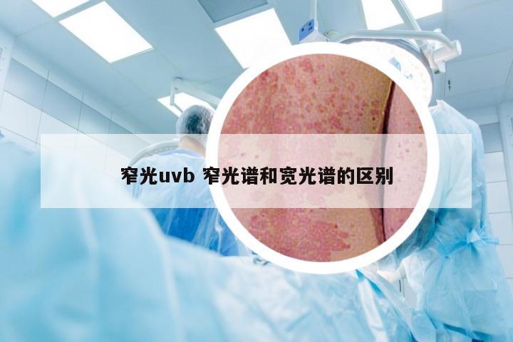 窄光uvb 窄光谱和宽光谱的区别