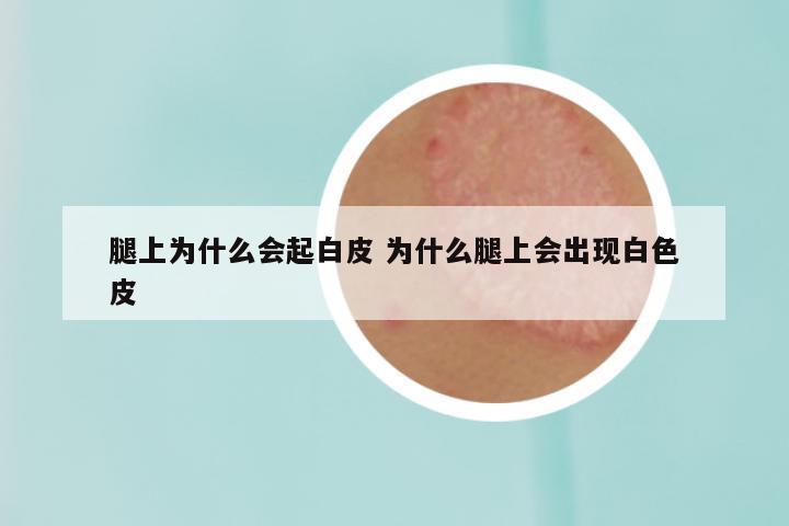 腿上为什么会起白皮 为什么腿上会出现白色皮