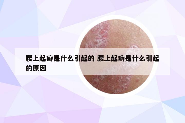 腰上起癣是什么引起的 腰上起癣是什么引起的原因