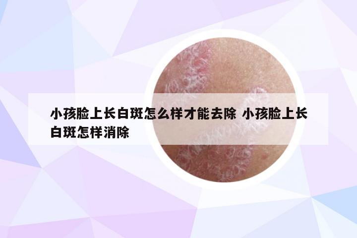 小孩脸上长白斑怎么样才能去除 小孩脸上长白斑怎样消除