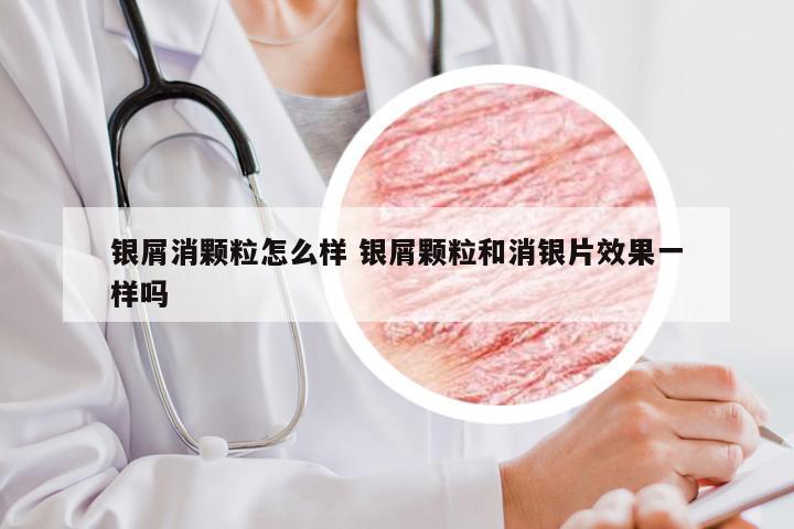 银屑消颗粒怎么样 银屑颗粒和消银片效果一样吗