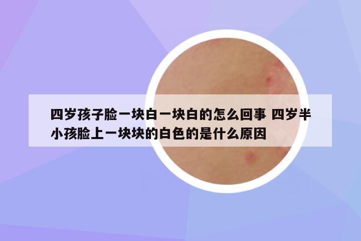 四岁孩子脸一块白一块白的怎么回事 四岁半小孩脸上一块块的白色的是什么原因